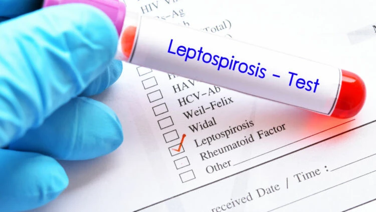 Langkah Menghambat Leptospirosis, Penyakit Kencing Tikus yang Menyebar di Musim Hujan!